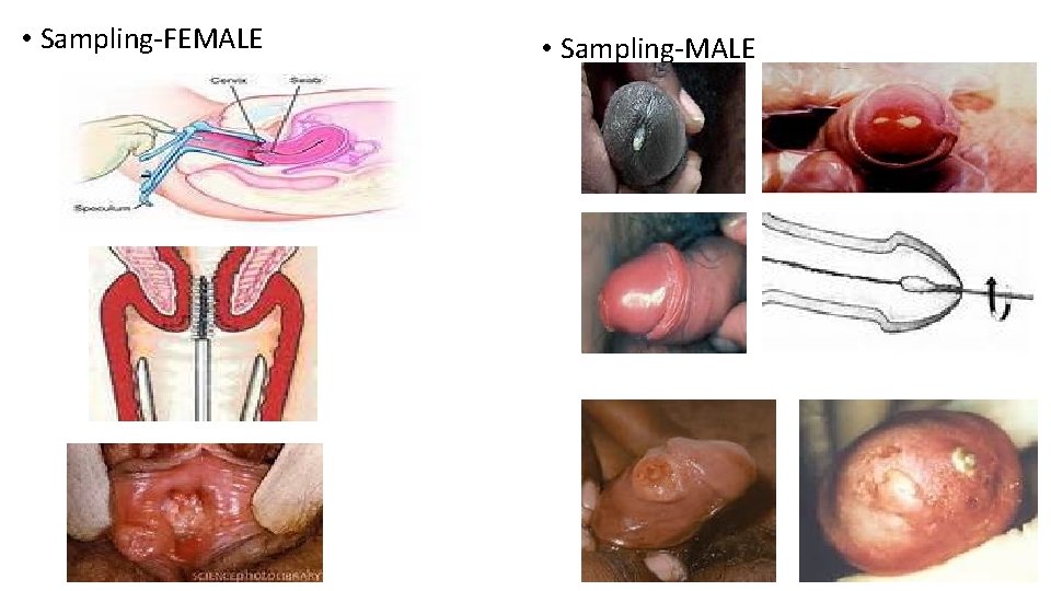  • Sampling-FEMALE • Sampling-MALE 