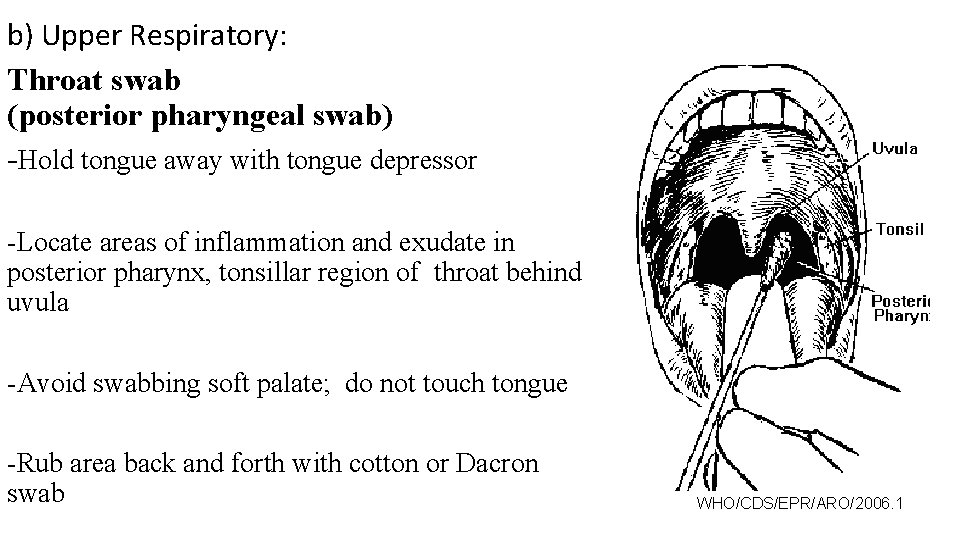 b) Upper Respiratory: Throat swab (posterior pharyngeal swab) -Hold tongue away with tongue depressor
