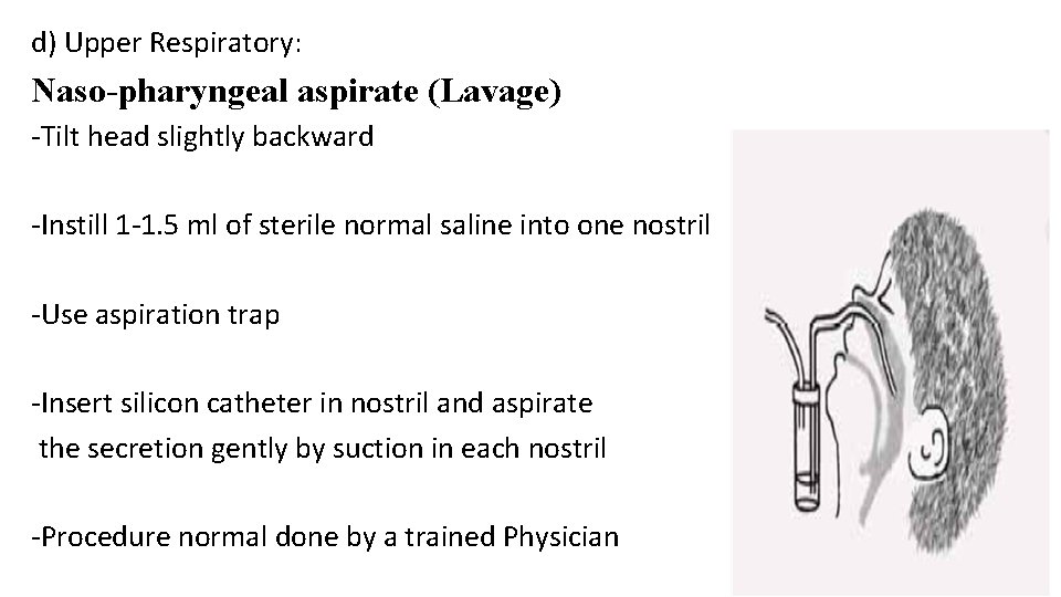 d) Upper Respiratory: Naso-pharyngeal aspirate (Lavage) -Tilt head slightly backward -Instill 1 -1. 5