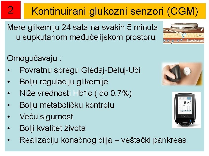 2 Kontinuirani glukozni senzori (CGM) Mere glikemiju 24 sata na svakih 5 minuta u