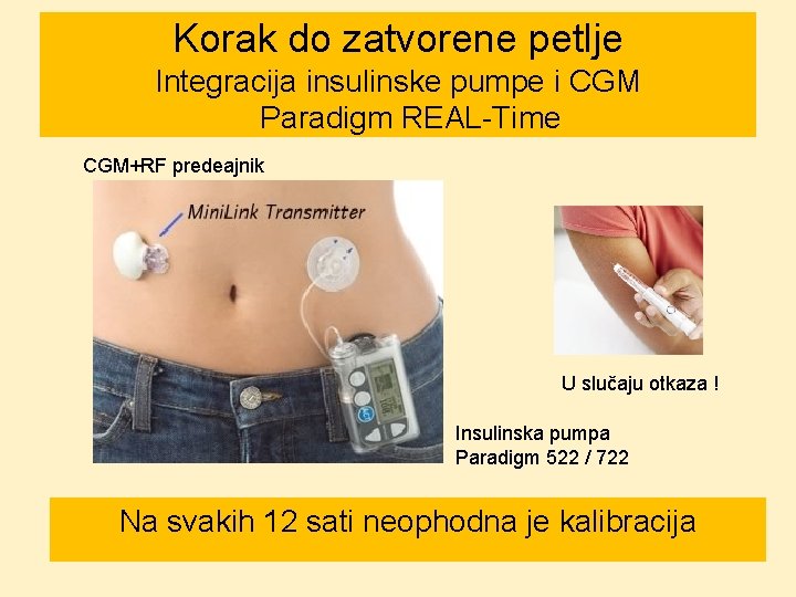 Korak do zatvorene petlje Integracija insulinske pumpe i CGM Paradigm REAL-Time CGM+RF predeajnik U