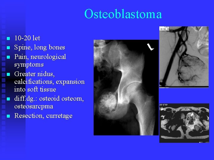 Osteoblastoma n n n 10 -20 let Spine, long bones Pain, neurological symptoms Greater