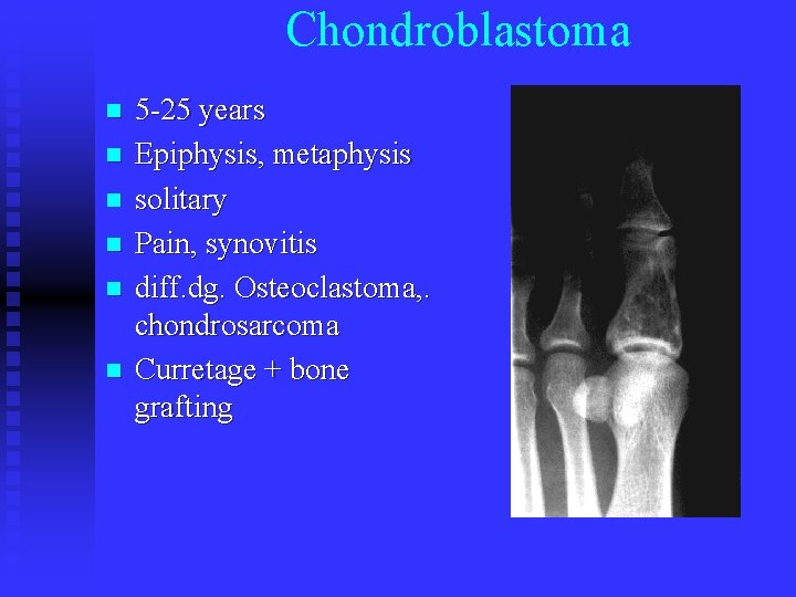 Chondroblastoma n n n 5 -25 years Epiphysis, metaphysis solitary Pain, synovitis diff. dg.