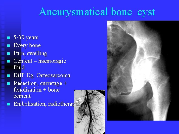 Aneurysmatical bone cyst n n n n 5 -30 years Every bone Pain, swelling