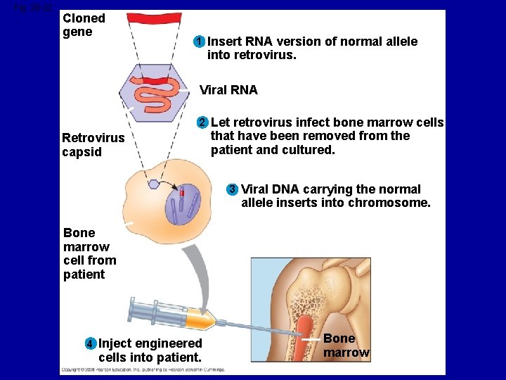 Fig. 20 -22 Cloned gene 1 Insert RNA version of normal allele into retrovirus.