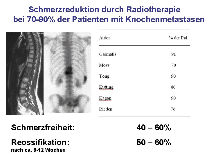 Schmerzreduktion durch Radiotherapie bei 70 -90% der Patienten mit Knochenmetastasen Schmerzfreiheit: 40 – 60%