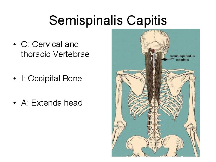 Semispinalis Capitis • O: Cervical and thoracic Vertebrae • I: Occipital Bone • A: