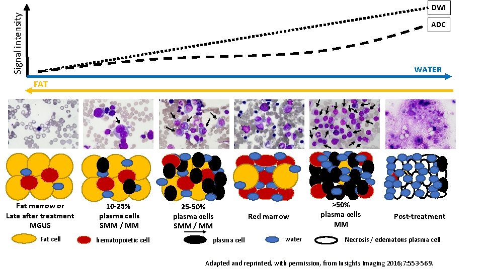 Signal intensity DWI ADC WATER FAT Fat marrow or Late after treatment MGUS Fat