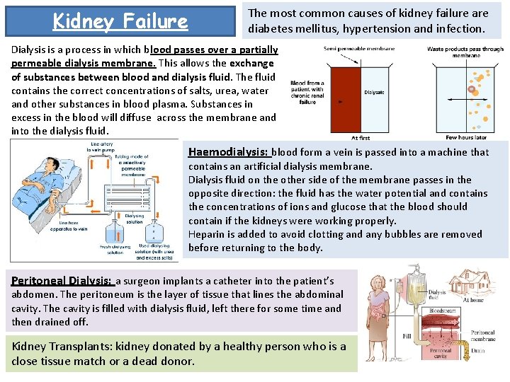 Kidney Failure The most common causes of kidney failure are diabetes mellitus, hypertension and