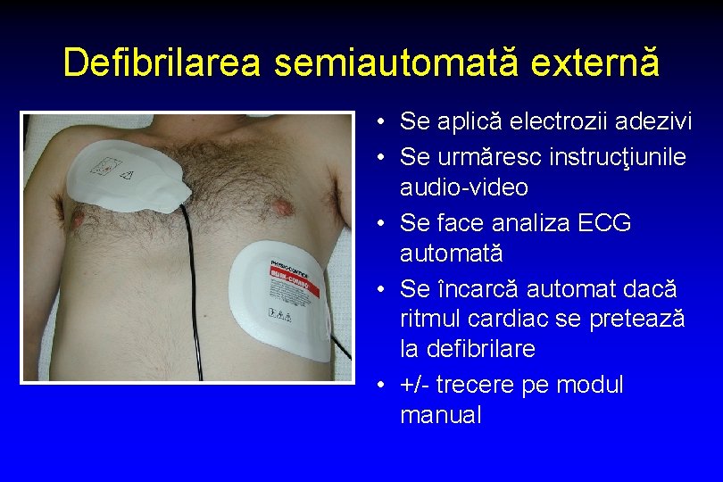 Defibrilarea semiautomată externă • Se aplică electrozii adezivi • Se urmăresc instrucţiunile audio-video •