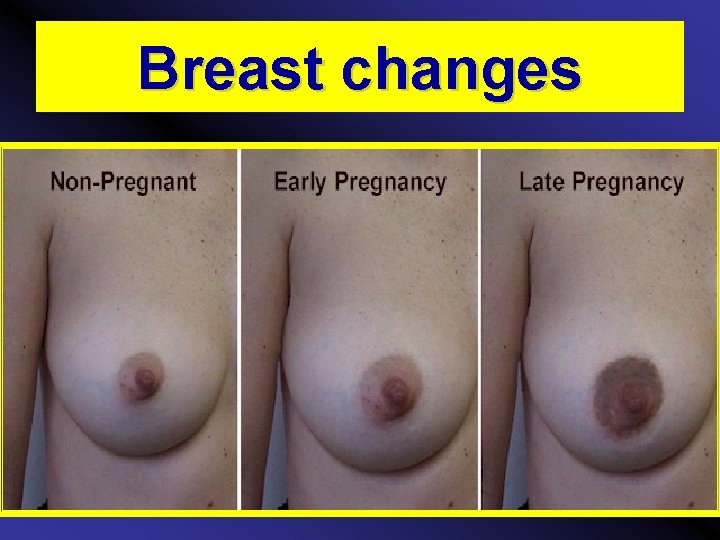 Breast changes 