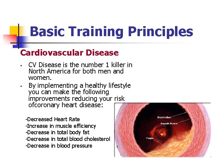 Basic Training Principles Cardiovascular Disease § § CV Disease is the number 1 killer
