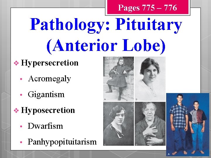 Pages 775 – 776 Pathology: Pituitary (Anterior Lobe) v Hypersecretion • Acromegaly • Gigantism