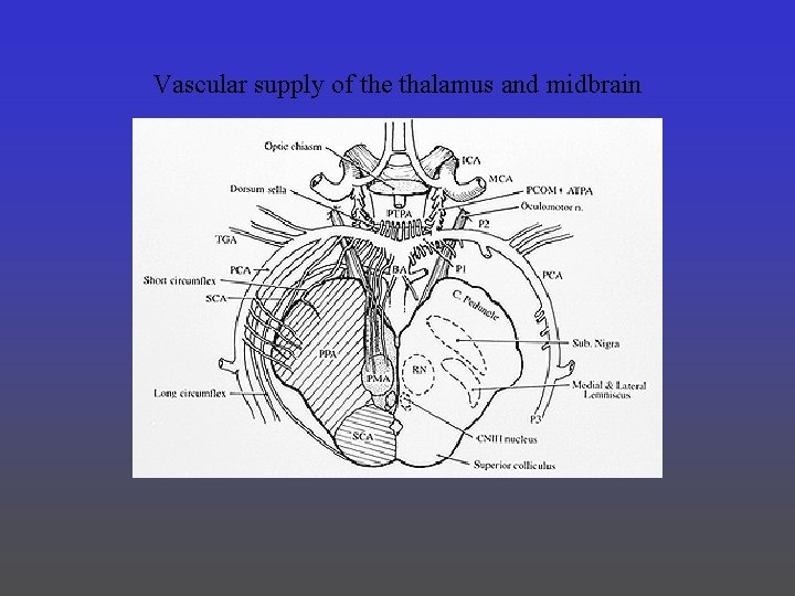 Vascular supply of the thalamus and midbrain 