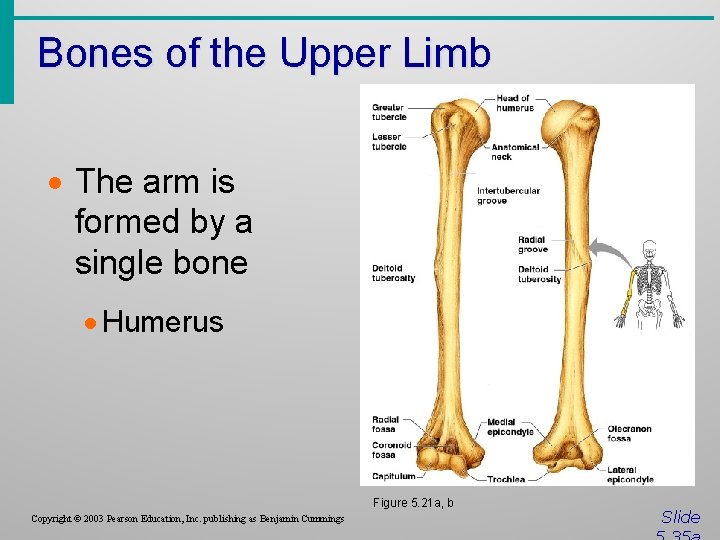 Bones of the Upper Limb · The arm is formed by a single bone