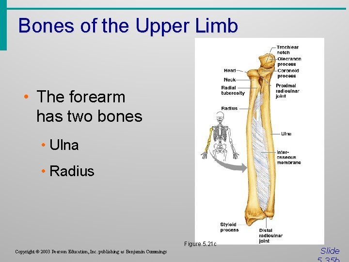 Bones of the Upper Limb • The forearm has two bones • Ulna •