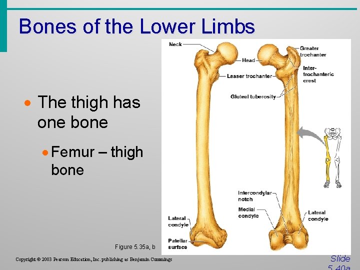 Bones of the Lower Limbs · The thigh has one bone · Femur –