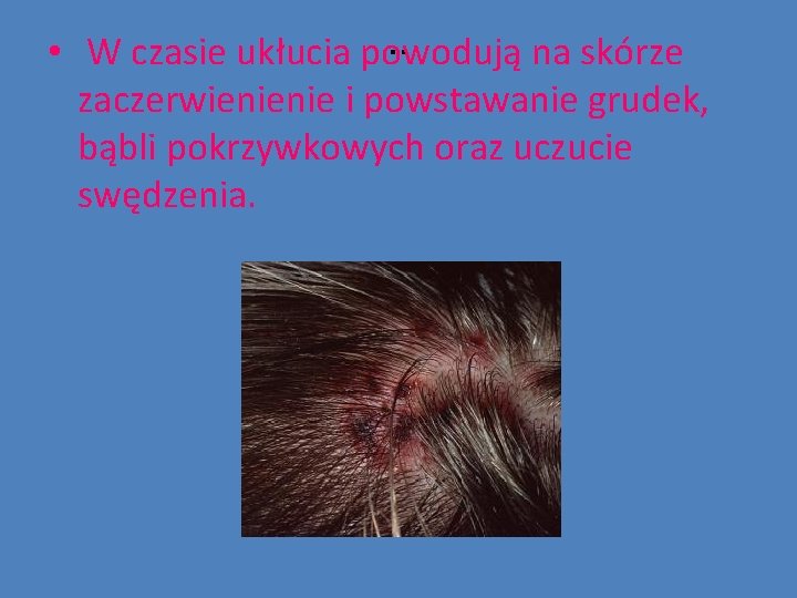 . . • W czasie ukłucia powodują na skórze zaczerwienienie i powstawanie grudek, bąbli