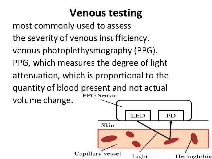 Venous testing most commonly used to assess the severity of venous insufficiency. venous photoplethysmography