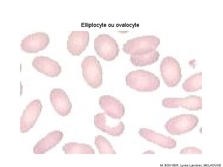 Elliptocyte ou ovalocyte M. BOUVIER, Lycée Lavoisier, MULHOUSE 