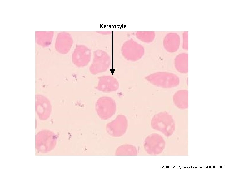 Kératocyte M. BOUVIER, Lycée Lavoisier, MULHOUSE 