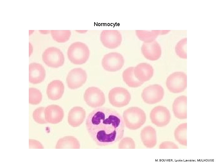 Normocyte M. BOUVIER, Lycée Lavoisier, MULHOUSE 