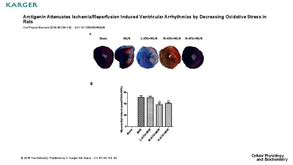 Arctigenin Attenuates Ischemia/Reperfusion Induced Ventricular Arrhythmias by Decreasing Oxidative Stress in Rats Cell Physiol