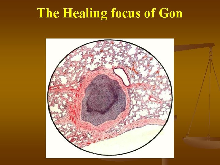 The Healing focus of Gon 