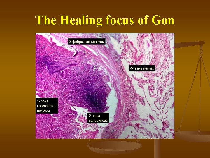 The Healing focus of Gon 