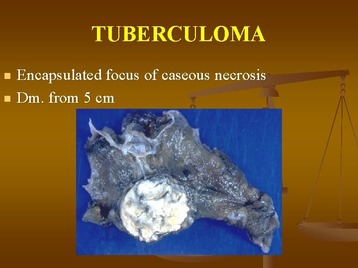 TUBERCULOMA n n Encapsulated focus of caseous necrosis Dm. from 5 cm 