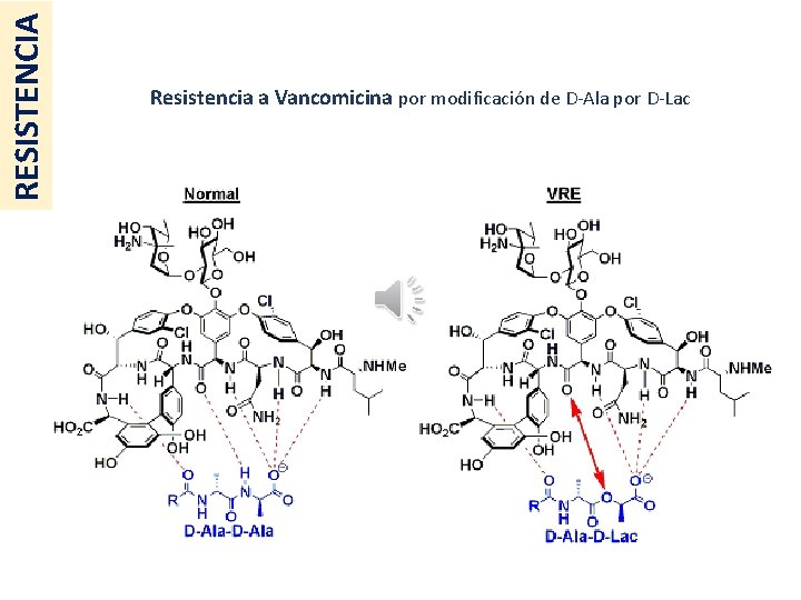 RESISTENCIA Resistencia a Vancomicina por modificación de D-Ala por D-Lac 