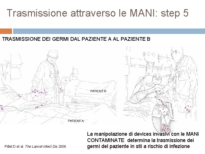 Trasmissione attraverso le MANI: step 5 TRASMISSIONE DEI GERMI DAL PAZIENTE A AL PAZIENTE