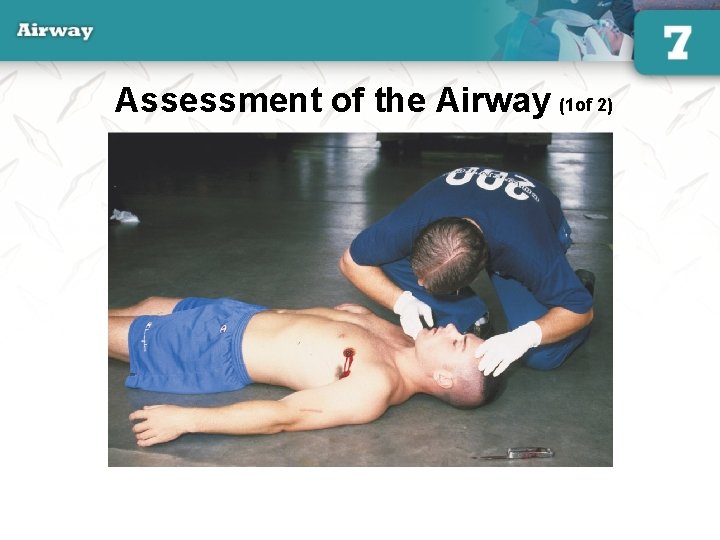 Assessment of the Airway (1 of 2) 26 