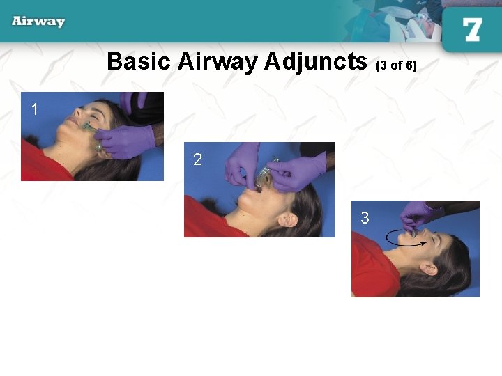 Basic Airway Adjuncts (3 of 6) 1 2 3 31 