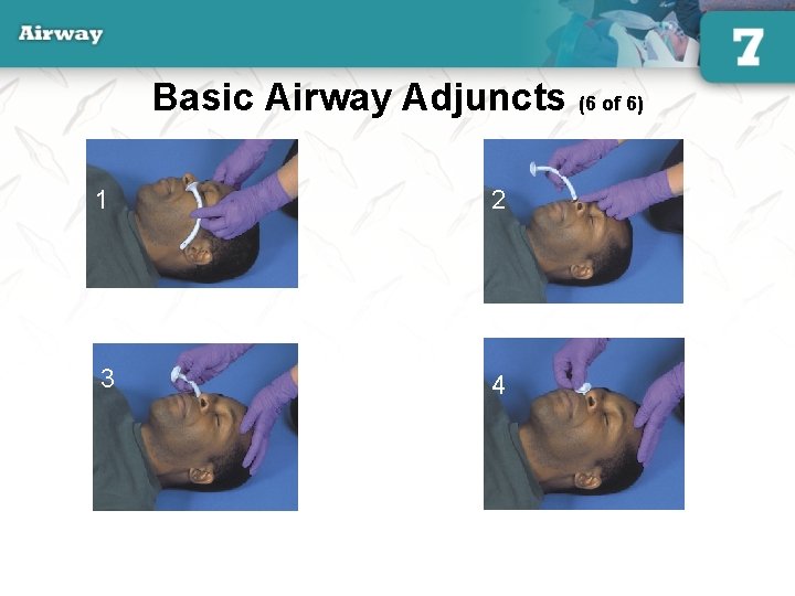 Basic Airway Adjuncts (6 of 6) 1 2 3 4 34 