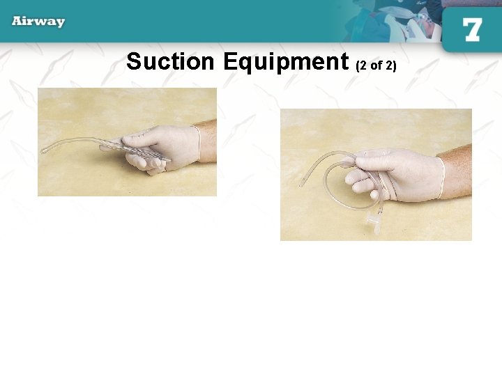 Suction Equipment (2 of 2) French, or whistle-tip, catheter 36 