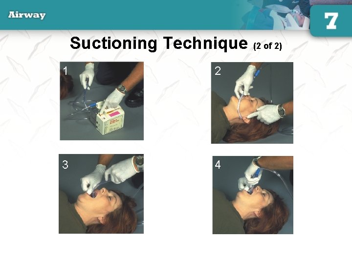 Suctioning Technique (2 of 2) 1 2 3 4 38 