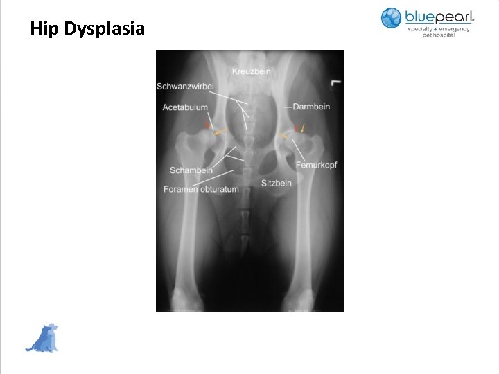 Hip Dysplasia 