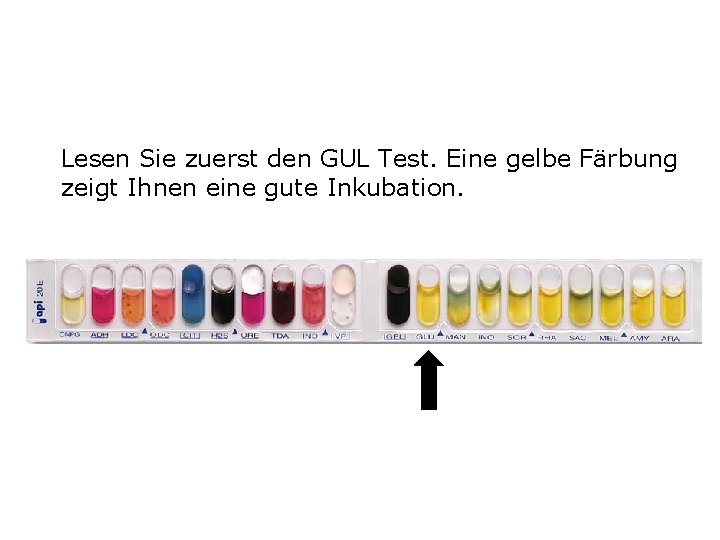 Lesen Sie zuerst den GUL Test. Eine gelbe Färbung zeigt Ihnen eine gute Inkubation.