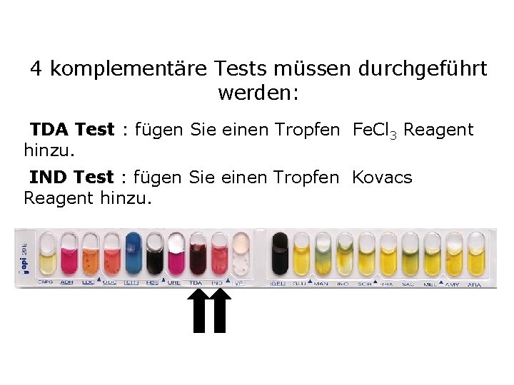 4 komplementäre Tests müssen durchgeführt werden: TDA Test : fügen Sie einen Tropfen Fe.