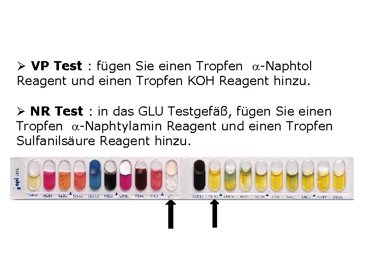 Ø VP Test : fügen Sie einen Tropfen -Naphtol Reagent und einen Tropfen KOH