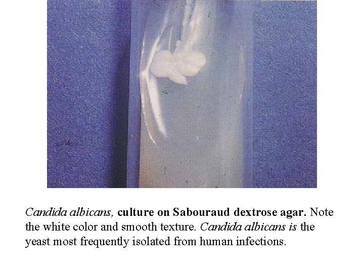 Candida albicans, culture on Sabouraud dextrose agar. Note the white color and smooth texture.