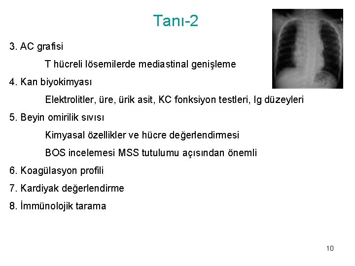Tanı-2 3. AC grafisi T hücreli lösemilerde mediastinal genişleme 4. Kan biyokimyası Elektrolitler, üre,