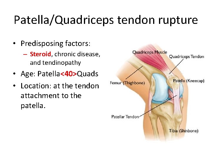 Patella/Quadriceps tendon rupture • Predisposing factors: – Steroid, chronic disease, and tendinopathy • Age: