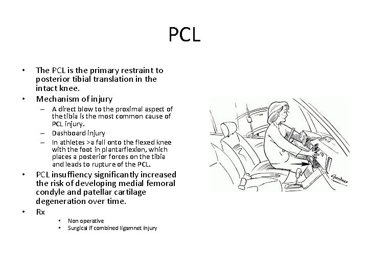 PCL • • The PCL is the primary restraint to posterior tibial translation in