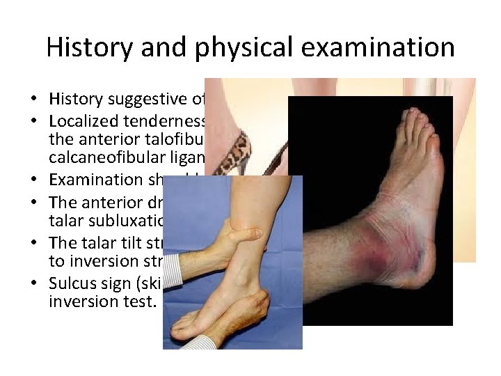 History and physical examination • History suggestive of inversion injury • Localized tenderness, swelling,