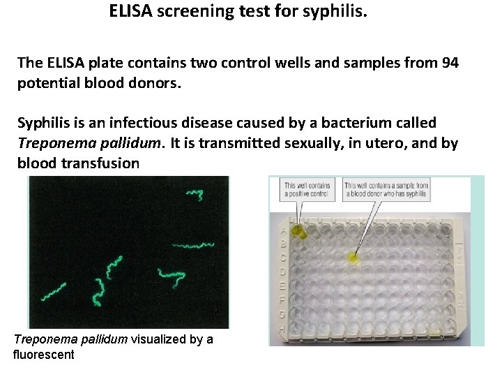 ELISA screening test for syphilis. The ELISA plate contains two control wells and samples