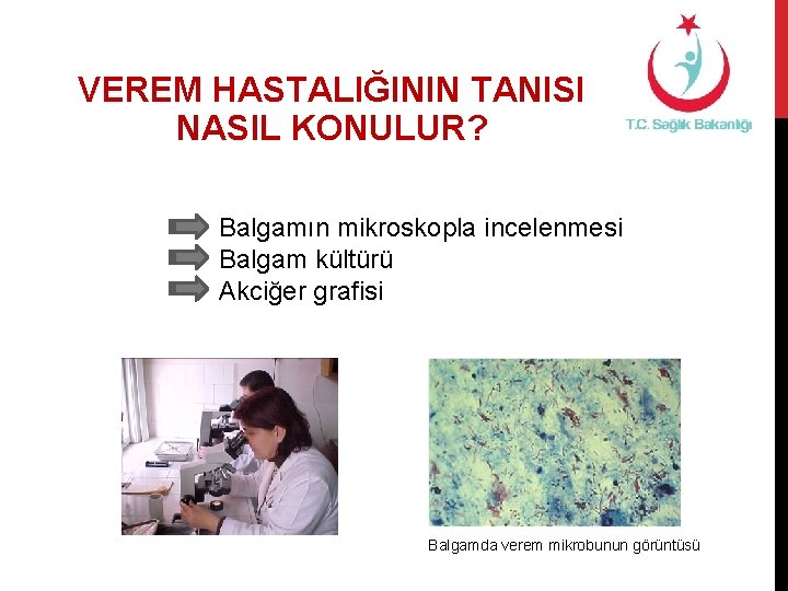 VEREM HASTALIĞININ TANISI NASIL KONULUR? Balgamın mikroskopla incelenmesi Balgam kültürü Akciğer grafisi Balgamda verem