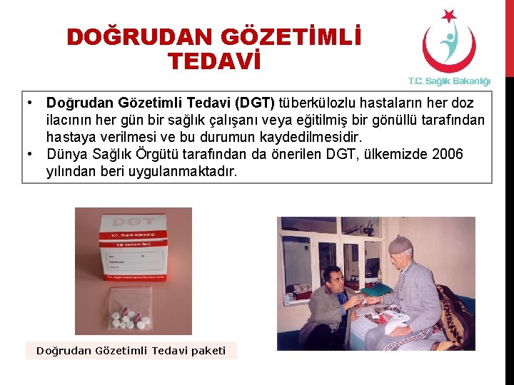 DOĞRUDAN GÖZETİMLİ TEDAVİ • Doğrudan Gözetimli Tedavi (DGT) tüberkülozlu hastaların her doz ilacının her