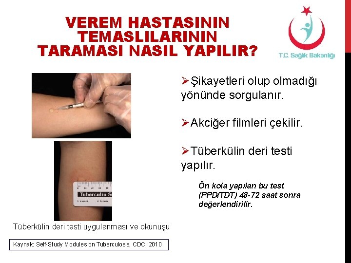 VEREM HASTASININ TEMASLILARININ TARAMASI NASIL YAPILIR? ØŞikayetleri olup olmadığı yönünde sorgulanır. ØAkciğer filmleri çekilir.